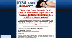 Desktop Screenshot of curatupsoriasisparasiempre.com